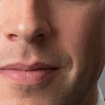 A close view of a man’s nose and mouth. Beside and below the nostril on one side there is a compact shadow that ends in lit skin, and further down, separated from it, a darker line runs toward the corner of his mouth.